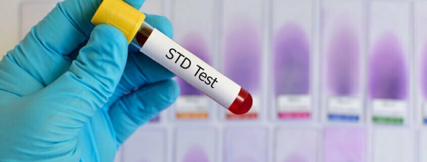 STI/STD testing services in Orange County