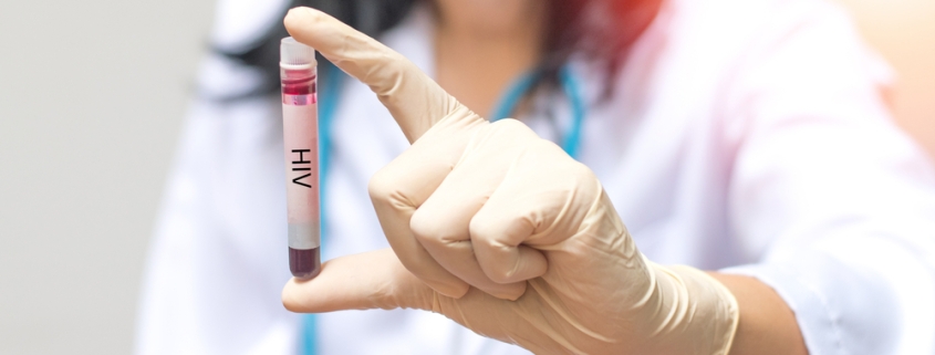 HIV testing and treatment services in Irvine.